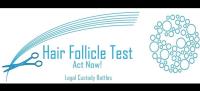 Hair Follicle Test image 2